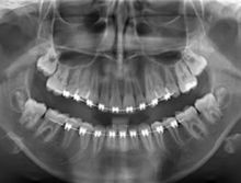 Justiça Federal/PB defere liminar em favor da odontologia contra Conselho de Técnicos em Radiologia